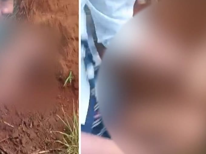 Lap Ki Khynnah Skul Ïa I Khyllung Ba Dang Kha Ba Tep Ha Khyndew, Dang Sumar Ki Doctor