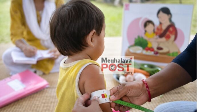 Meghalaya Records Significant Improvement In Child Nutrition Nfhs 6 Shows Representative Image